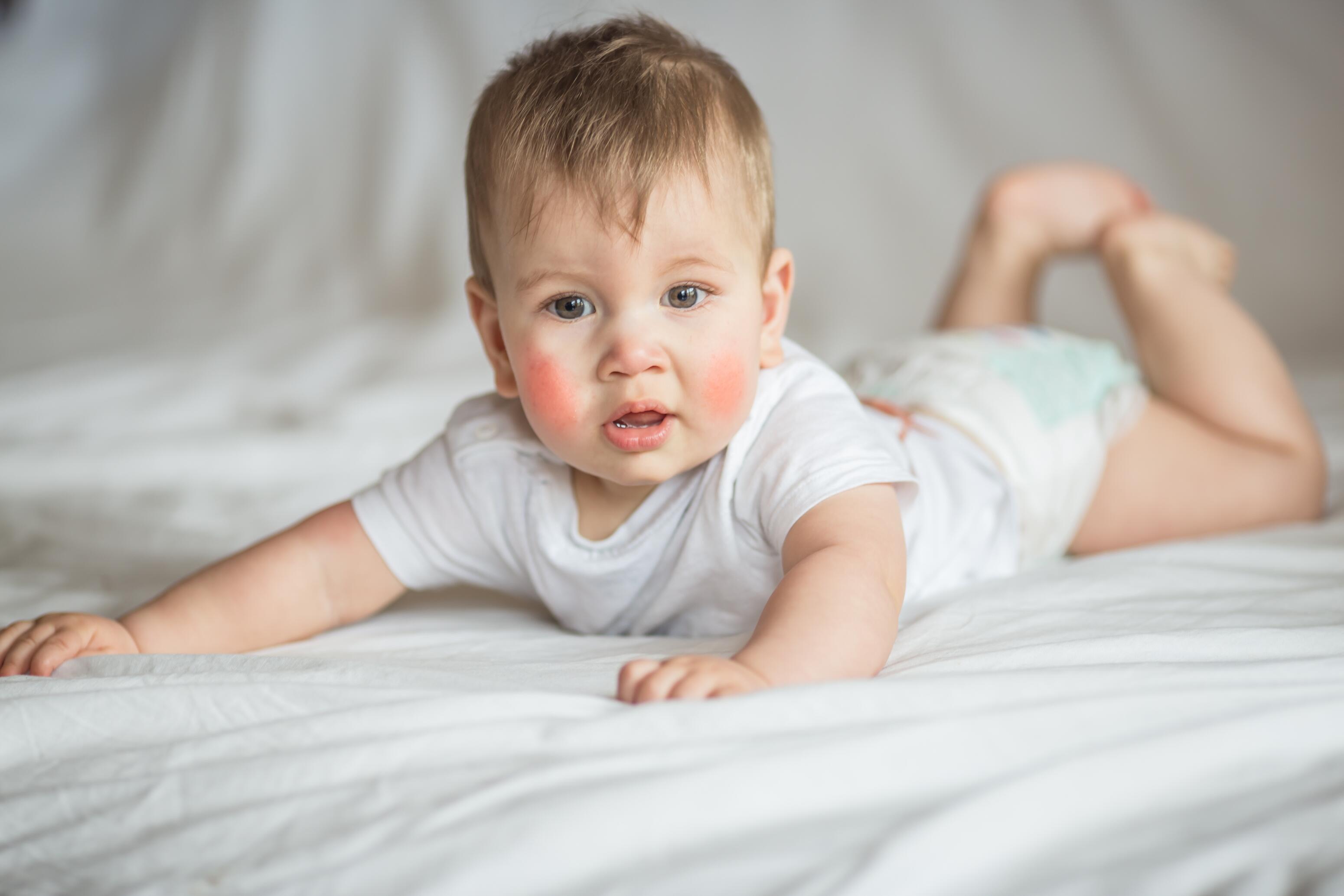 Atopowe zapalenie skóry